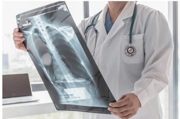 doctor holding an xray of lungs