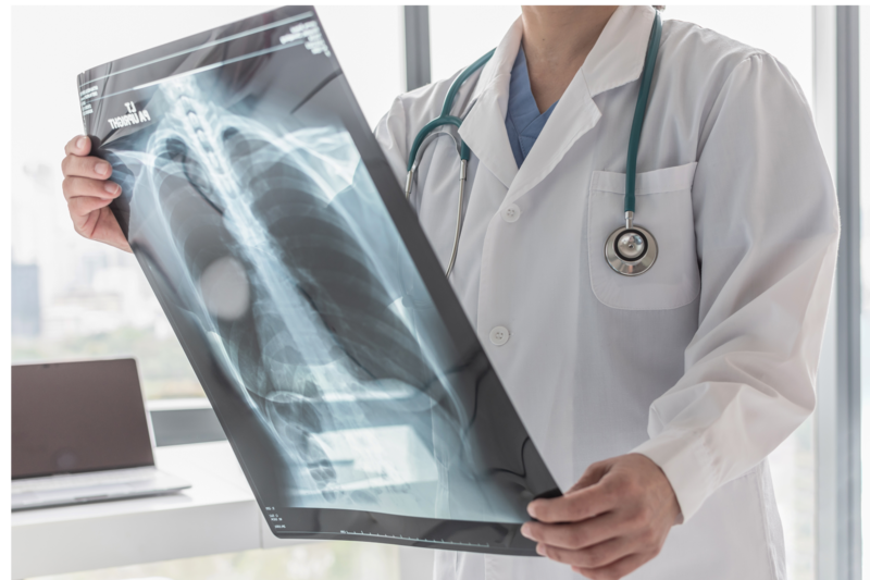 doctor holding an xray of lungs